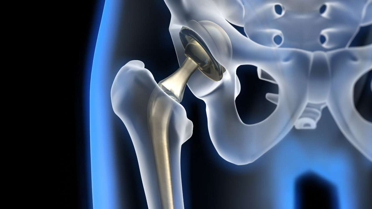 Ученые Тюменского медицинского университета создают новые биоимплантаты для лечения пациентов с костной патологией