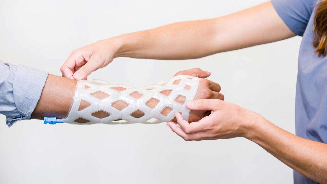 В России разработали новый материал для фиксации конечностей при переломах